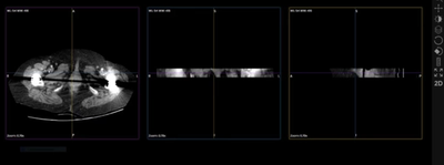 Top 5 Best Online DICOM Viewer to Open your Medical Images