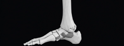 X-Ray of the Ankle: How It Identifies Sprains, Fractures, and Joint Issues