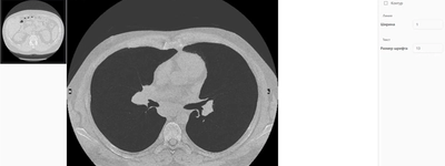 MIP и MinIP: два волшебных режима, которые нужно знать каждому, кто смотрит КТ