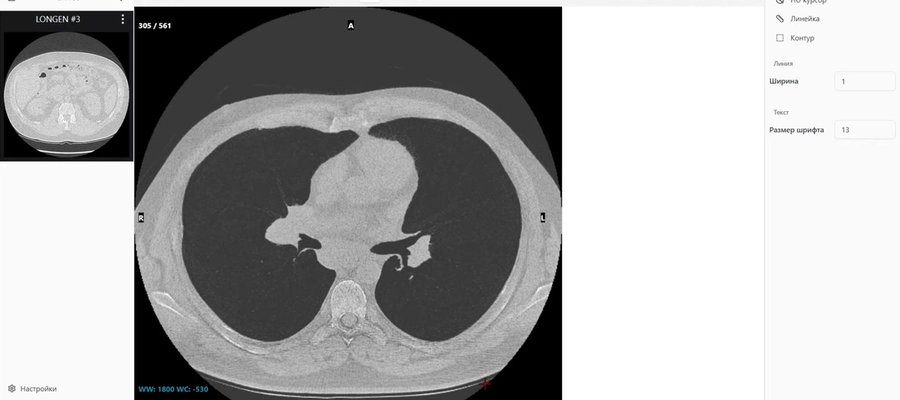 MIP и MinIP: два волшебных режима, которые нужно знать каждому, кто смотрит КТ