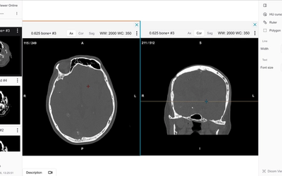 After uploading the files, you'll be able to view and analyze medical images directly in your browser. Use the viewing tools to navigate through slices, adjust contrast, and create annotations.