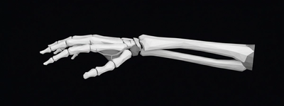 X-Ray of the Wrist: Diagnosing Injuries, Pain Causes, and Bone Damage