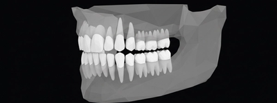 X-Ray of Baby Teeth: What It Shows, When It’s Needed, and Safety Tips