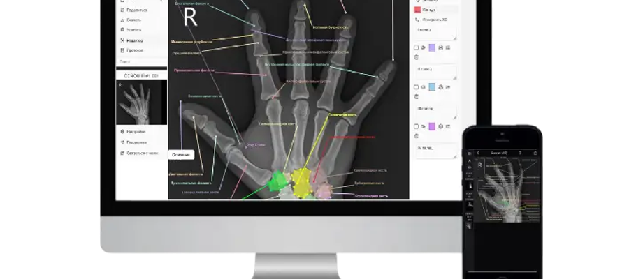 Как открыть DICOM онлайн?