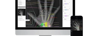 Как открыть DICOM онлайн?
