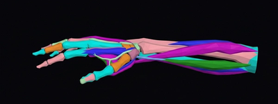 X-Ray of the Hand: Detecting Fractures, Arthritis, and Bone Abnormalities