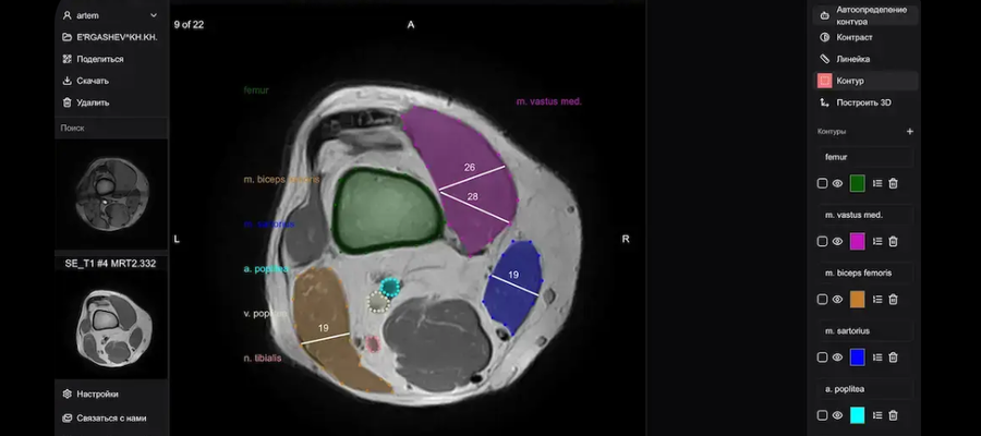 Рентген коленного сустава: анатомия, процедура и чего ожидать