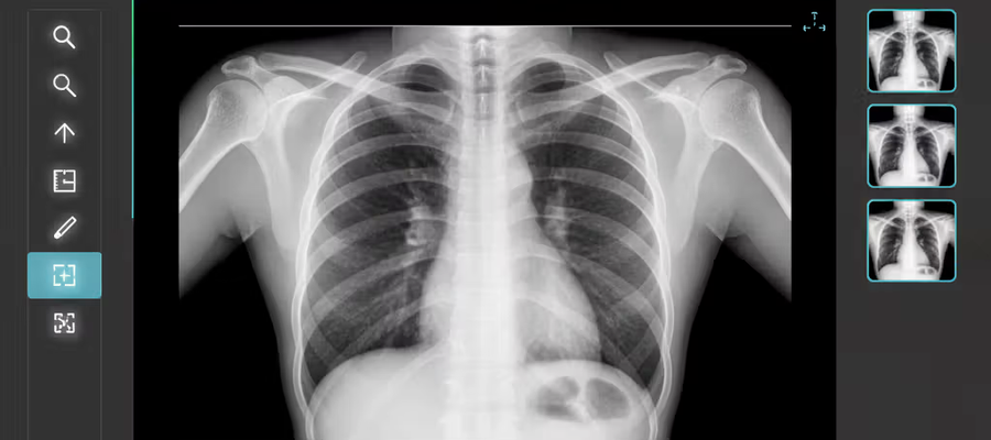 Как пользоваться DICOM вьюером: Практическое пошаговое руководство для врачей и студентов