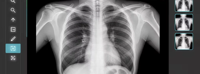 Как пользоваться DICOM вьюером: Практическое пошаговое руководство для врачей и студентов