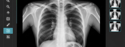 How to Use a DICOM Viewer: A Practical Step-by-Step Guide for Medical Professionals and Learners