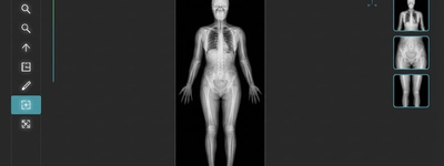 Full Body X-Ray: Benefits and What to Expect