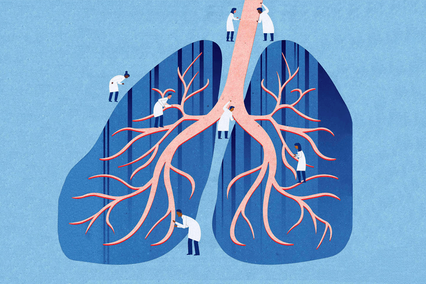 Illustration lungorna