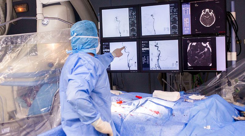 En trombektomi och samtidig angiografi av hjärnan utförs på en patient med stroke.
