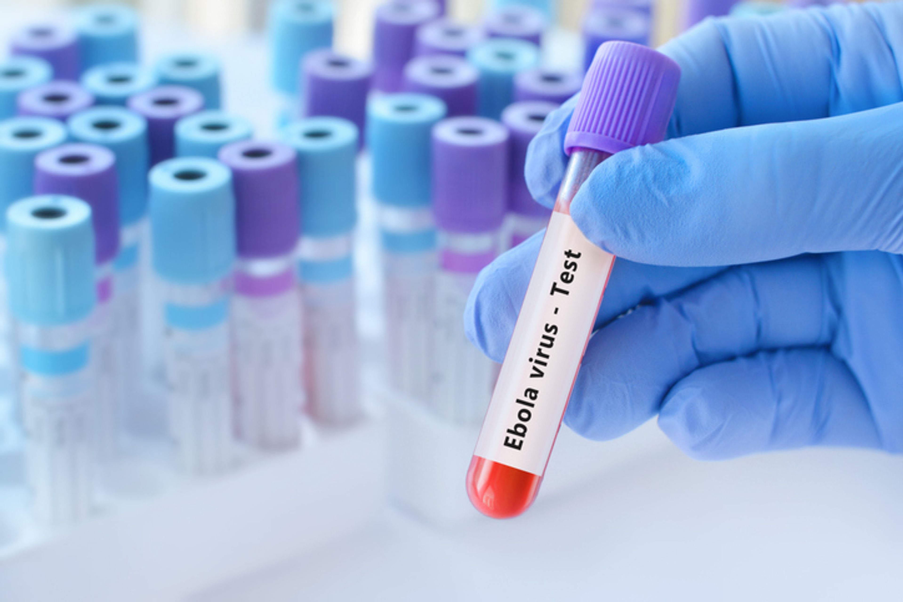 Doctor holding a test blood sample tube with Ebola virus test.