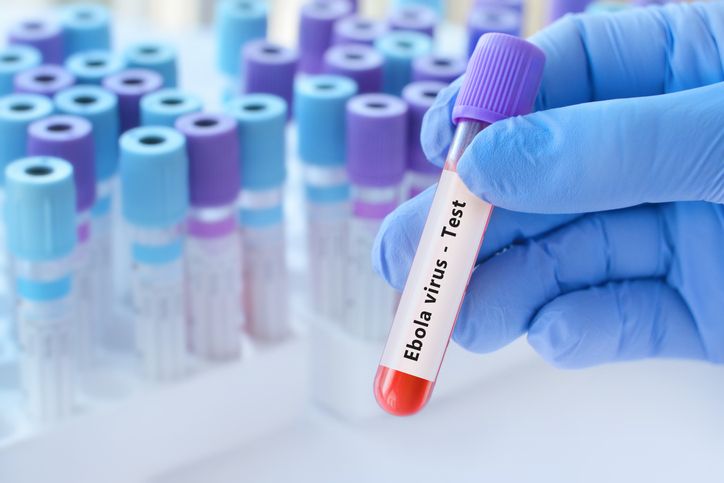 Doctor holding a test blood sample tube with Ebola virus test.