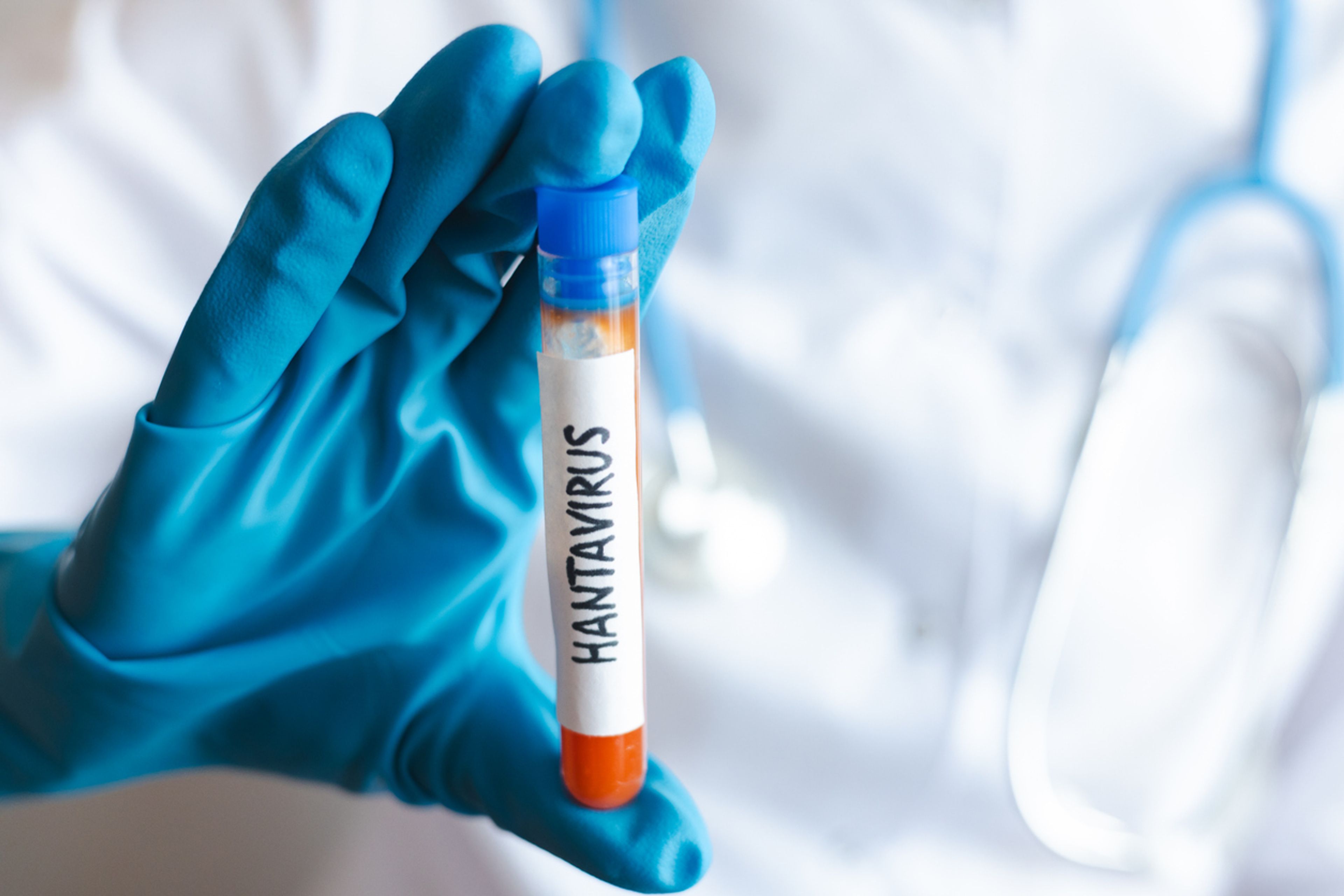 A few crewmembers in MV Hondius cruise ship docked at Cao Verde first reported a case of hantavirus flu in early May, 2026. A representative image.