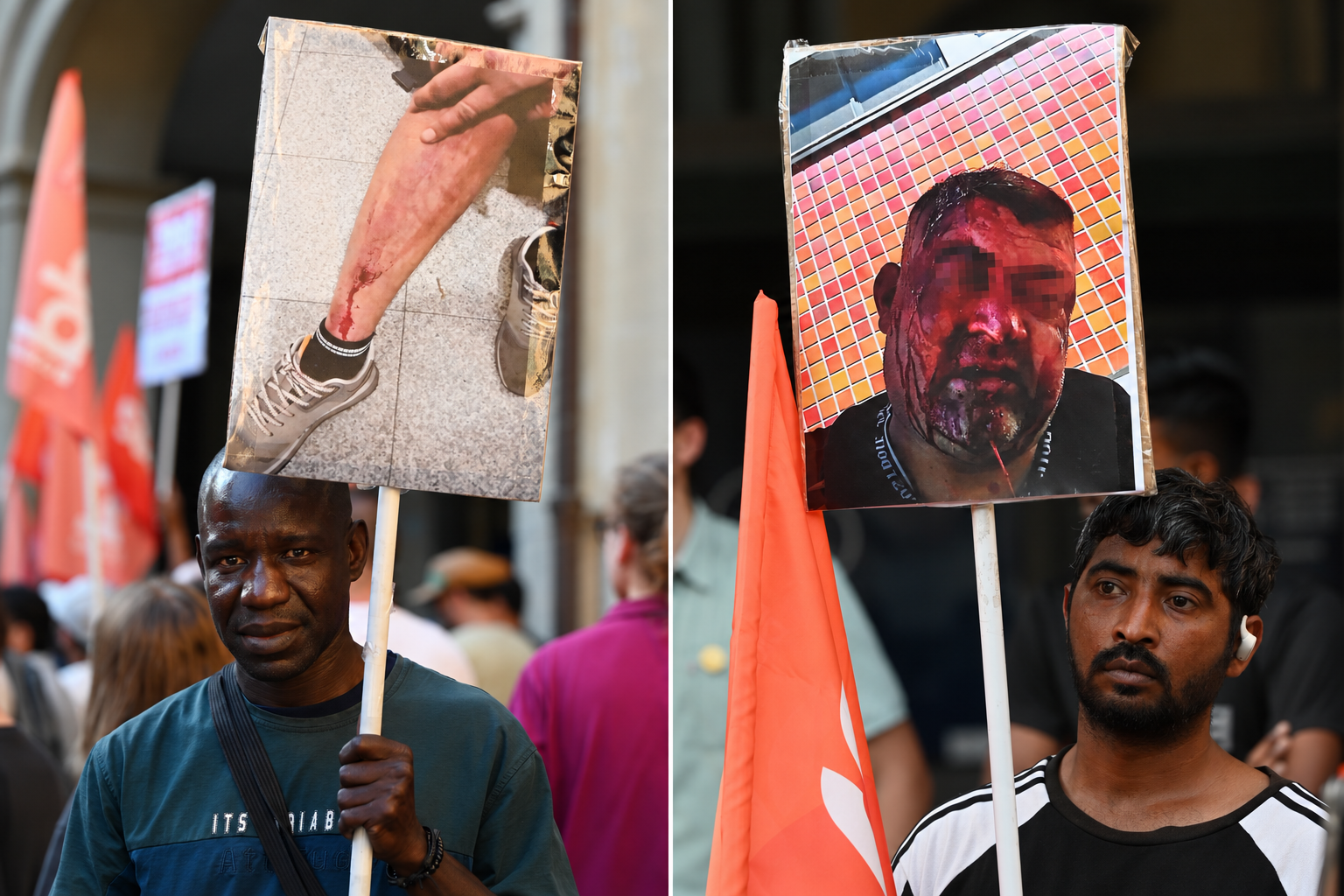 A North African and a South Asian worker carry placards depicting colleagues with injuries during a march in Prato, Italy, on July 6, 2026. Photo: Special Arrangement/Sudd Cobas