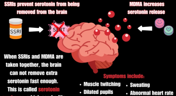 serotonin-syndrome-how-antidepressant-medications-and-mdma-interact-in-the-brain