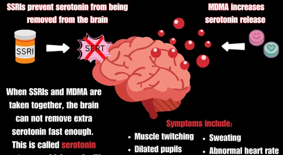 serotonin-syndrome-how-antidepressant-medications-and-mdma-interact-in-the-brain