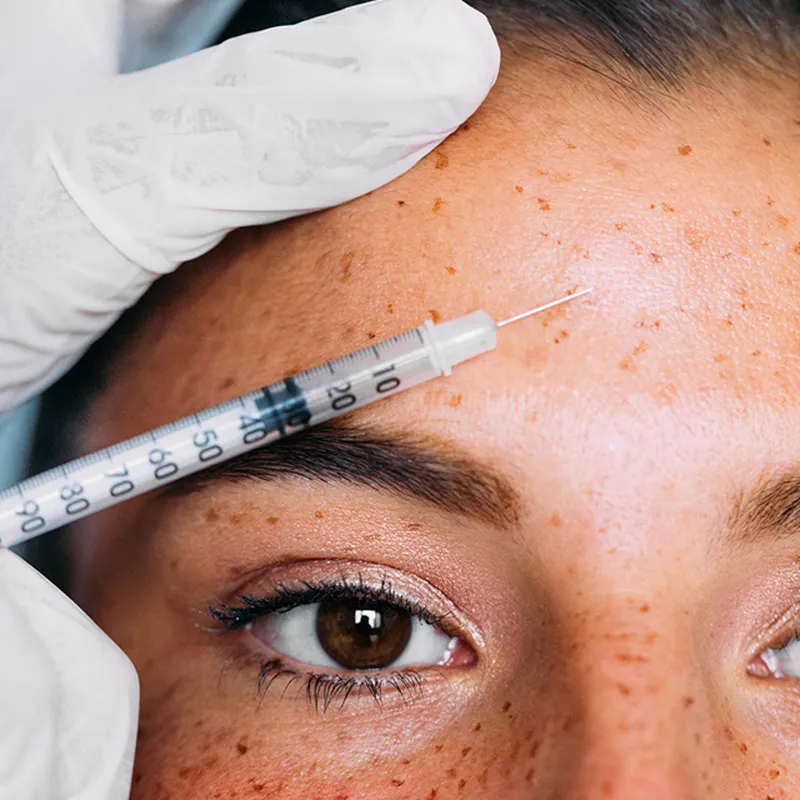 Why Botox Doesn’t Build Collagen