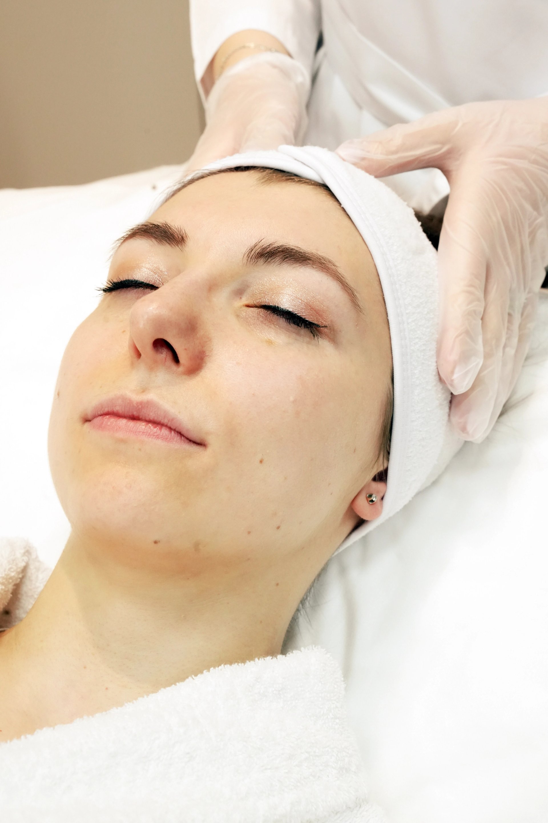 Chemical Peels Explained: Types, Recovery, and What to Expect Day by Day