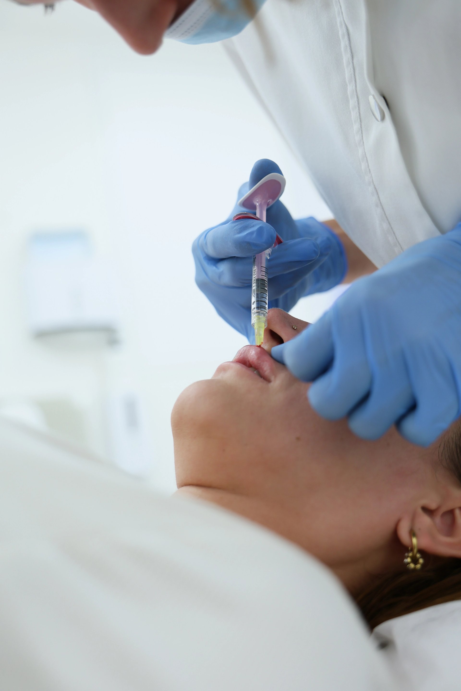 Preparing for Lip Fillers