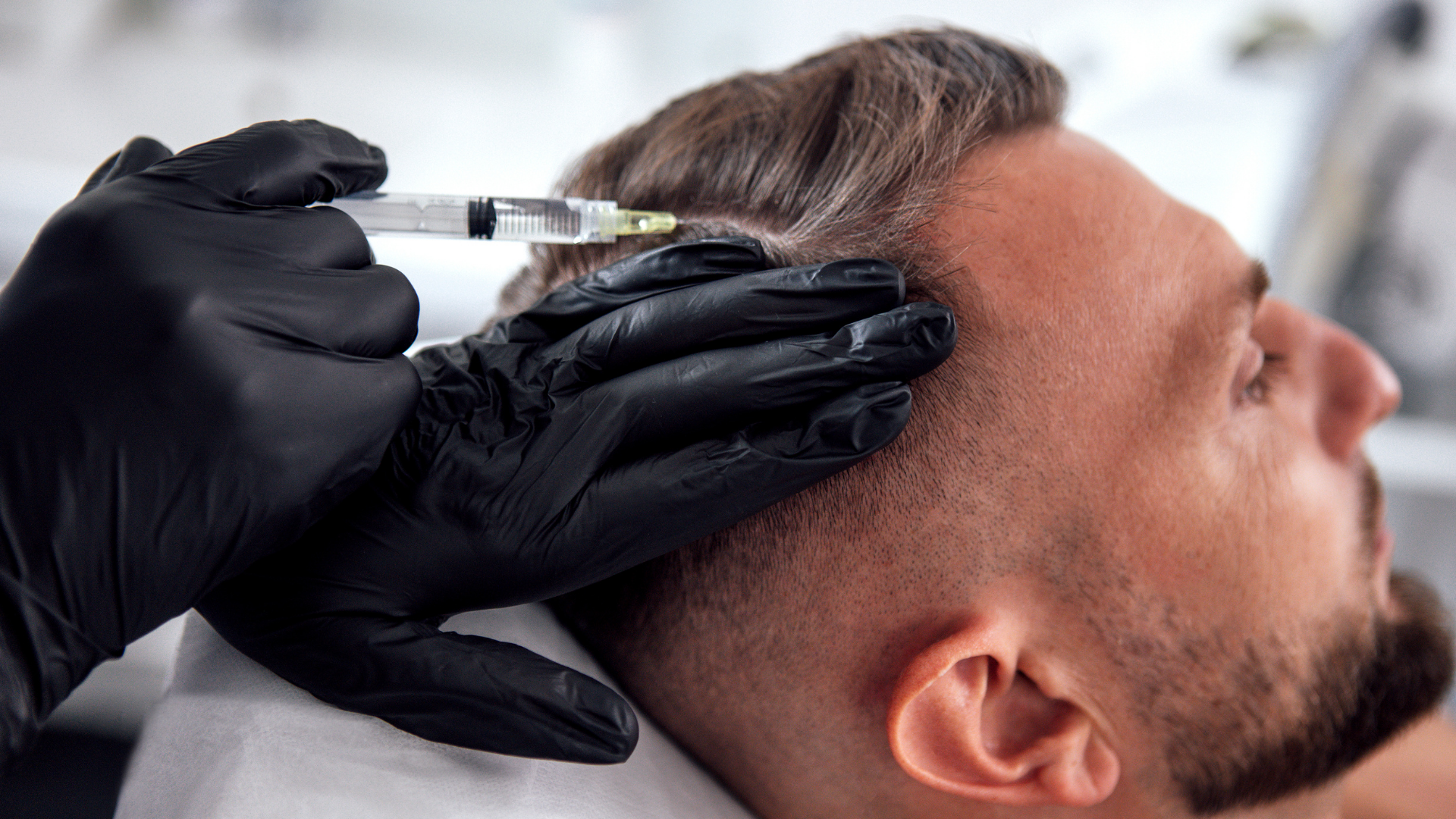 Hair Mesotherapy