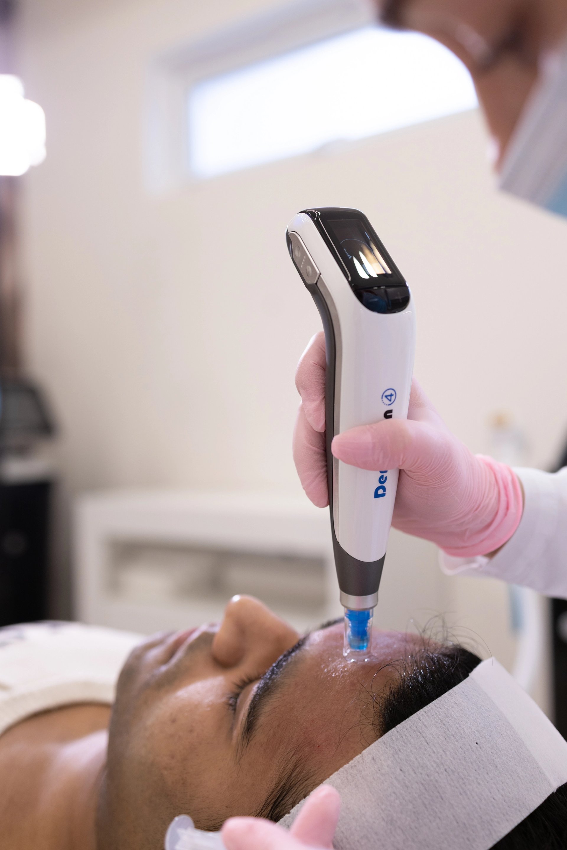 Vampire Glow: Dermapen + Exosomes*!