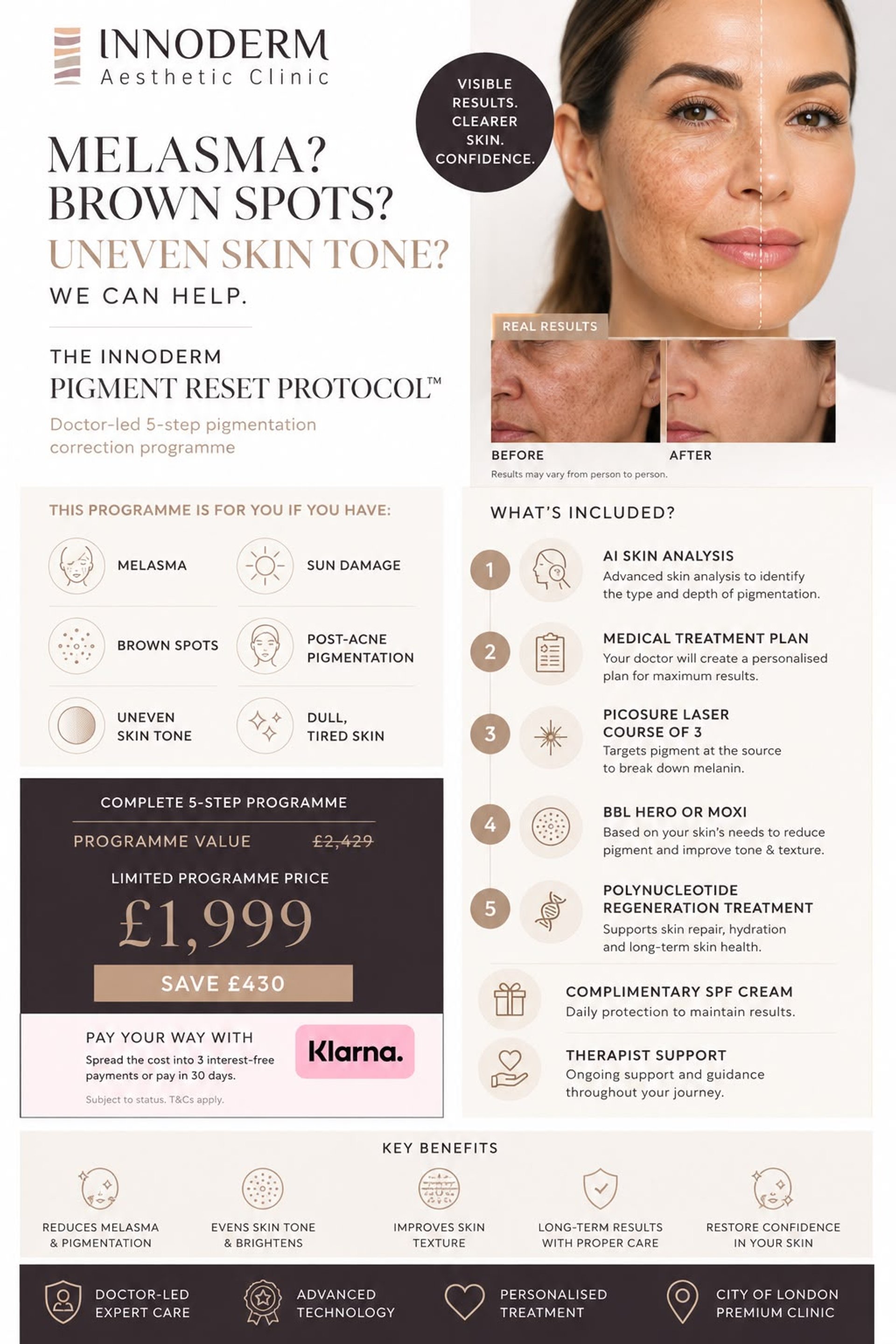 Pigmentation & Dark Spots treatment programme