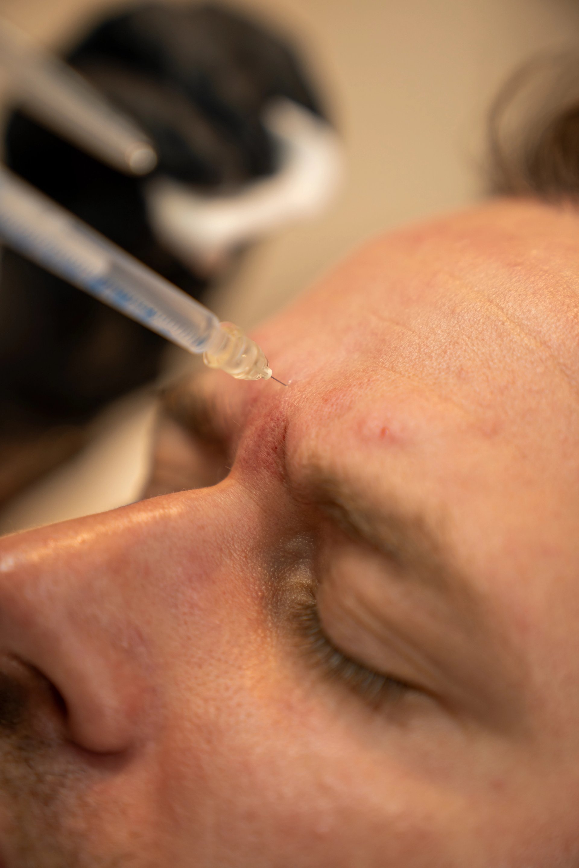 Preparing for Anti-Wrinkle Injections