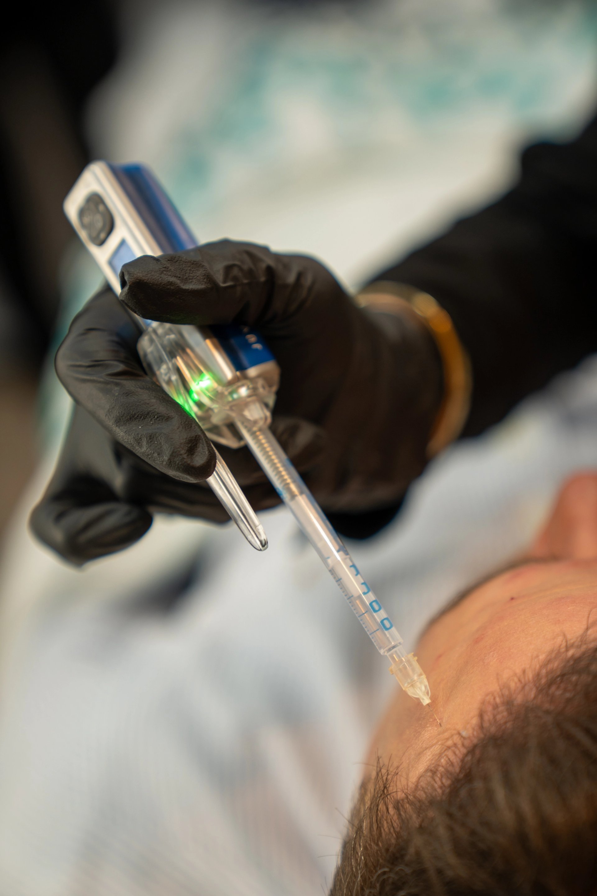 Special Offer: Anti-Wrinkle Injections – Full Face + Neck — only £590 