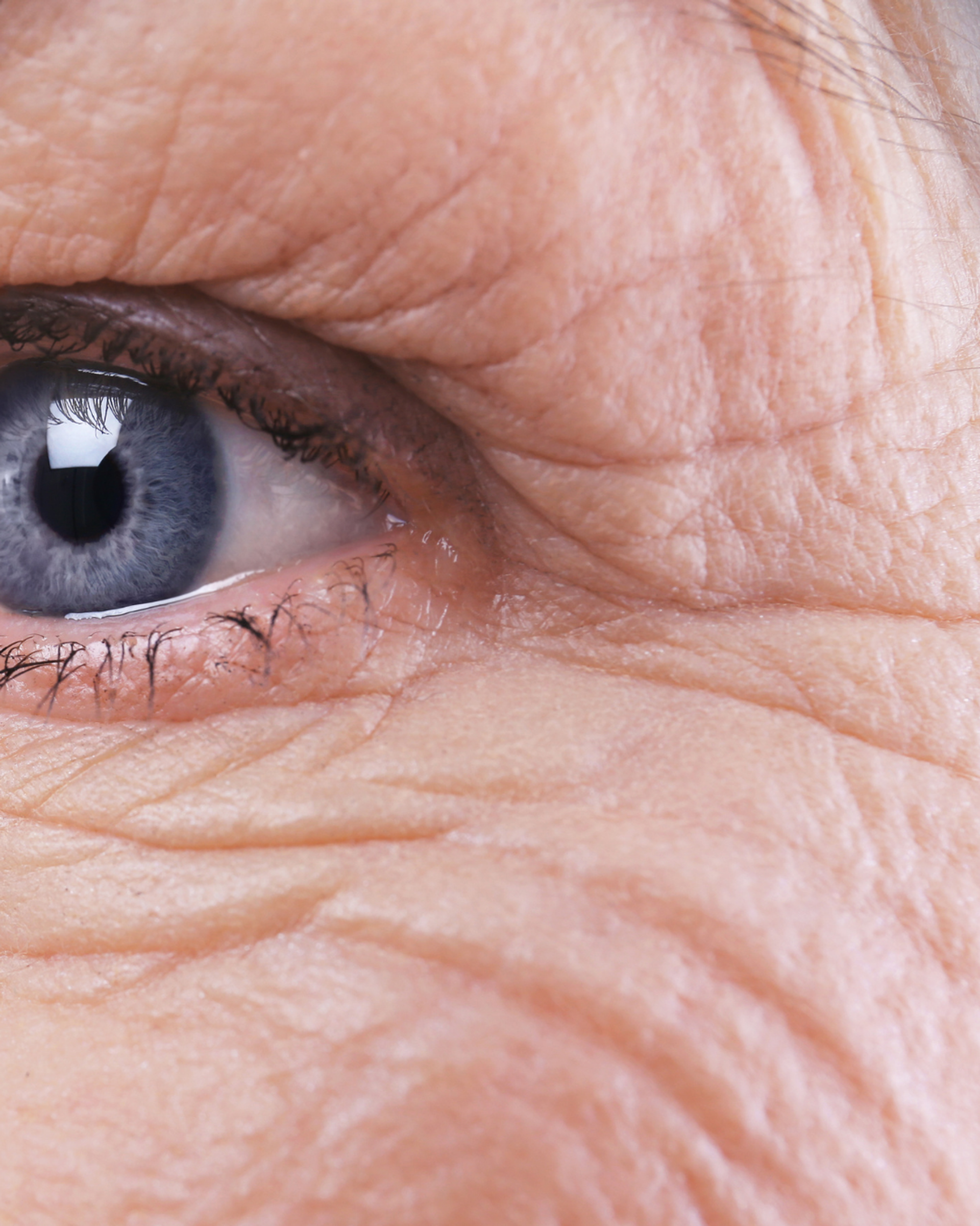 Wrinkles & Fine Lines