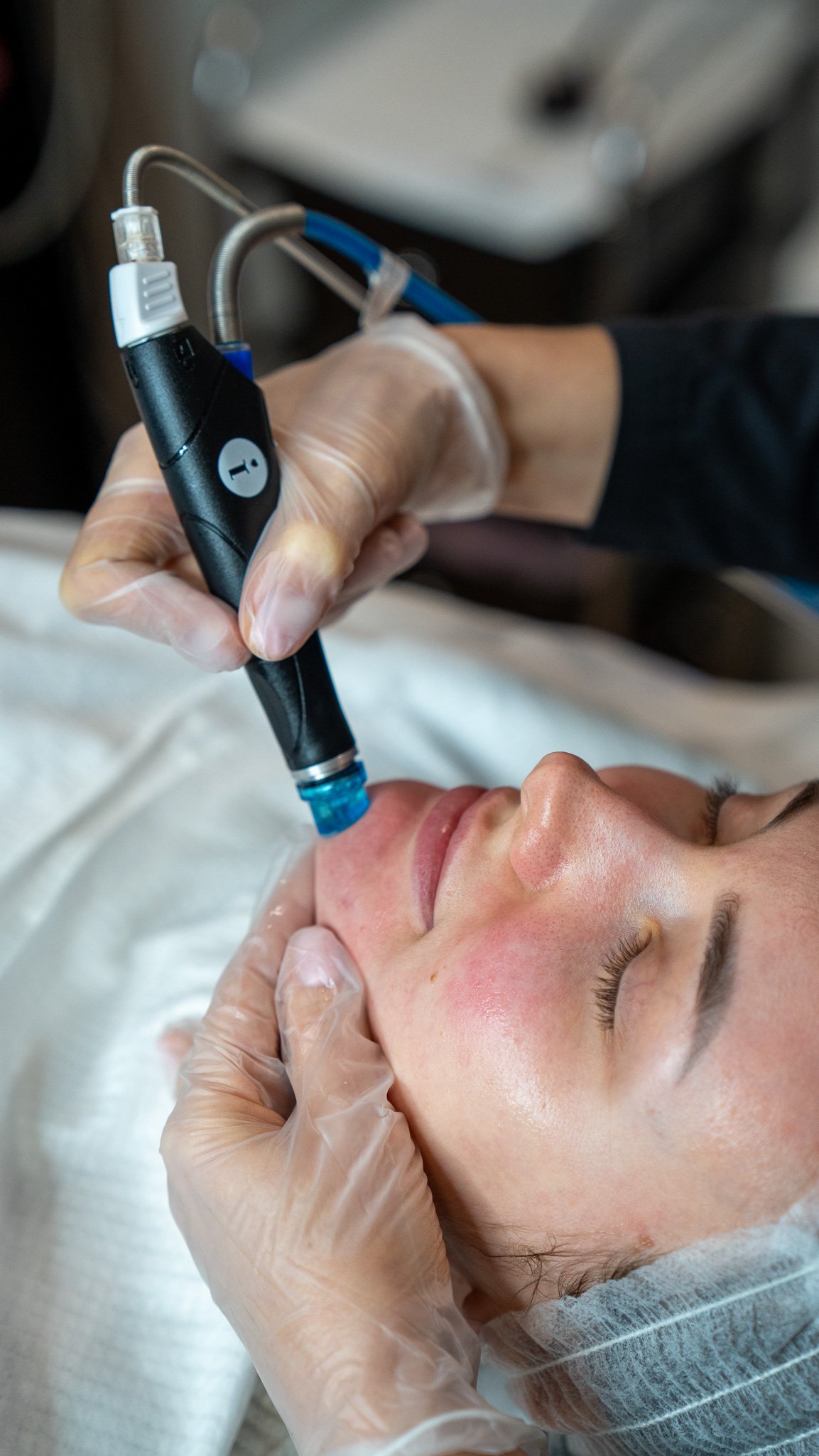 The UK’s most in-demand skin cleansing treatment Hydrafacial only £99/ session