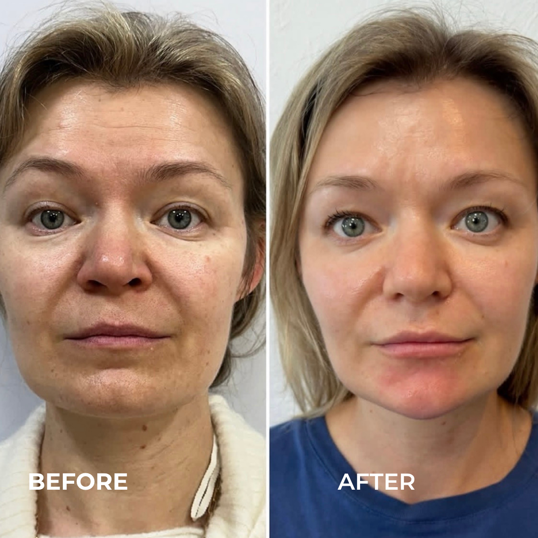 The Best Treatments for Ageing Skin: Firmness, Pigmentation and Skin Glow