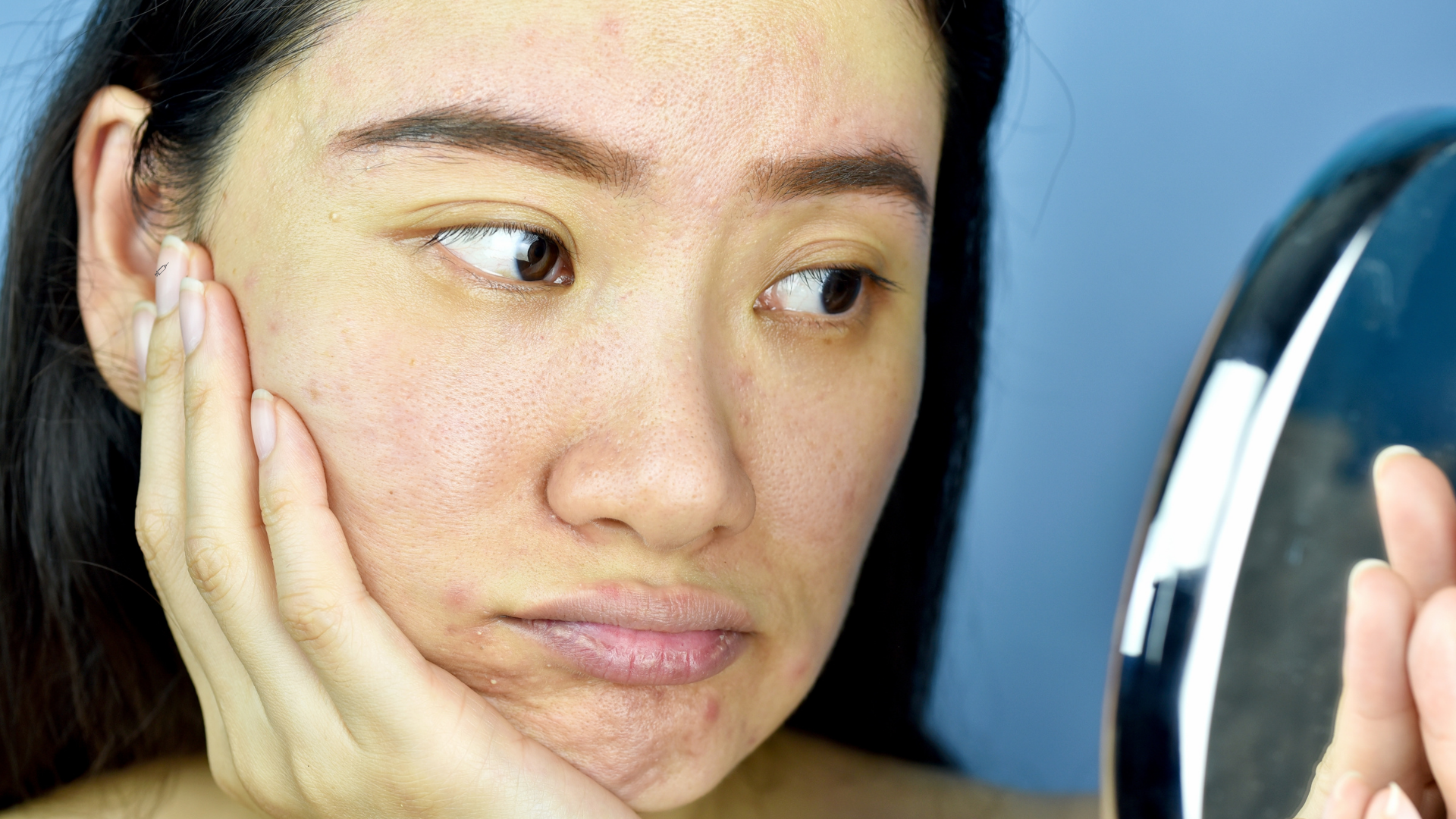 Why Does Your Skin Look Dull After Summer?