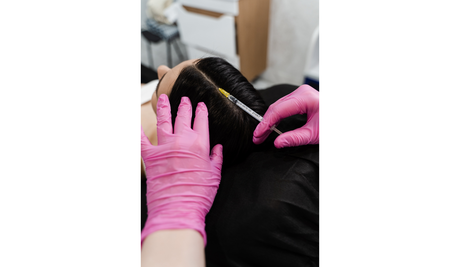 Preparing for Hair Mesotherapy
