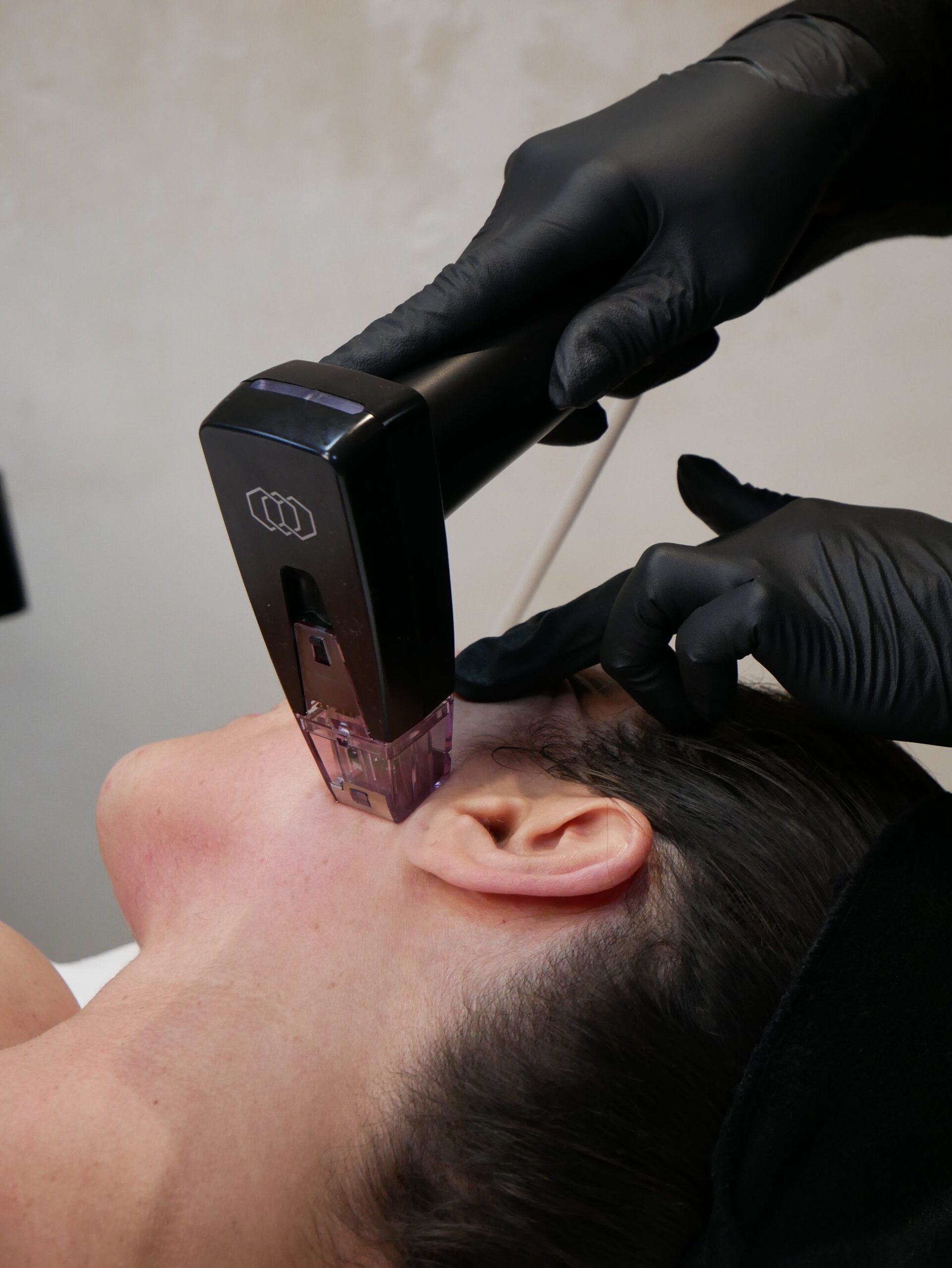 Full Face Morpheus8 with Complimentary Neck