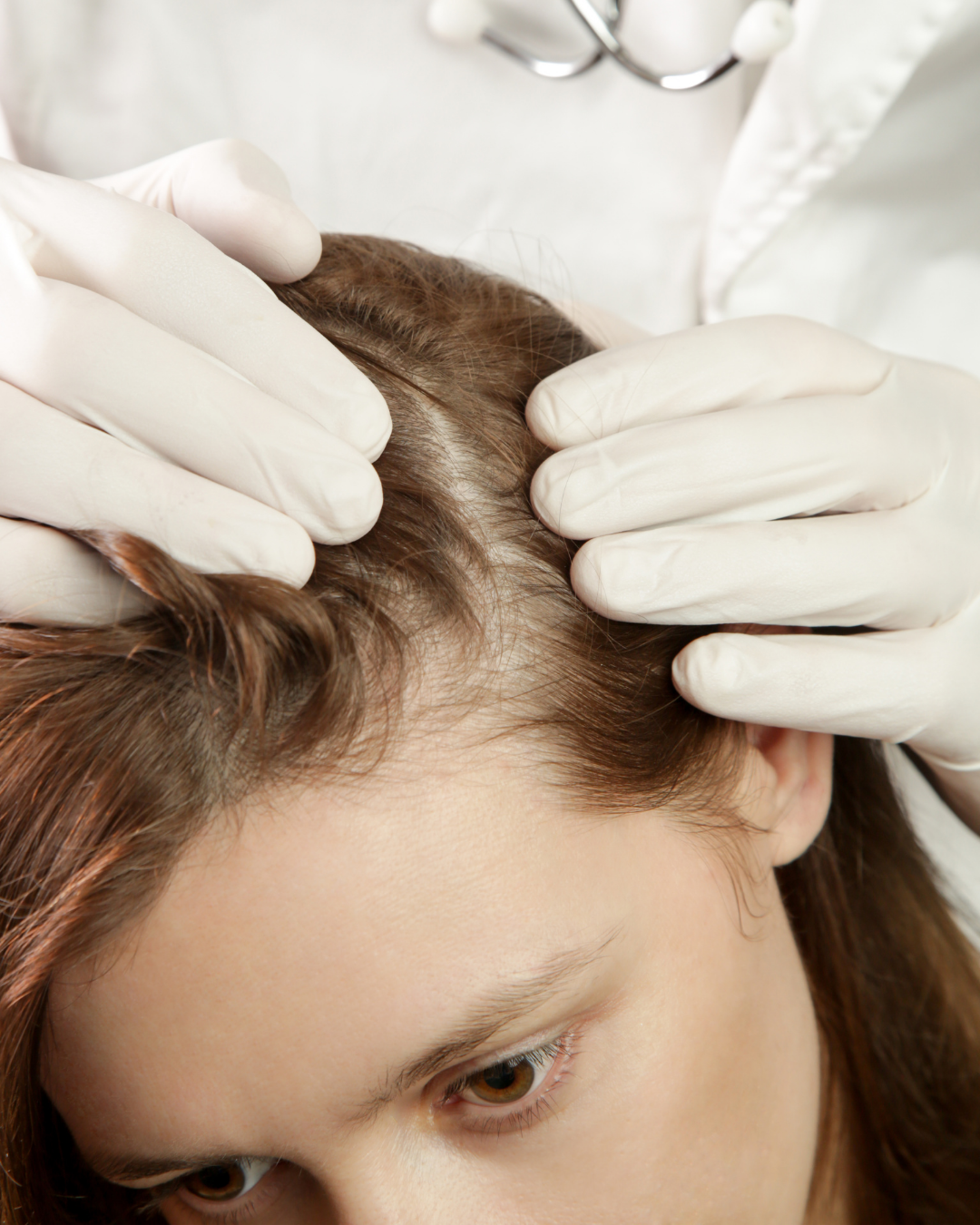 Hair Loss & Thinning