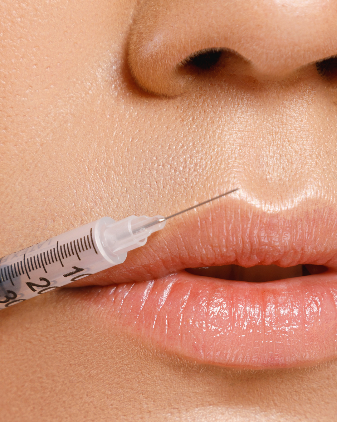Lip Enhancement