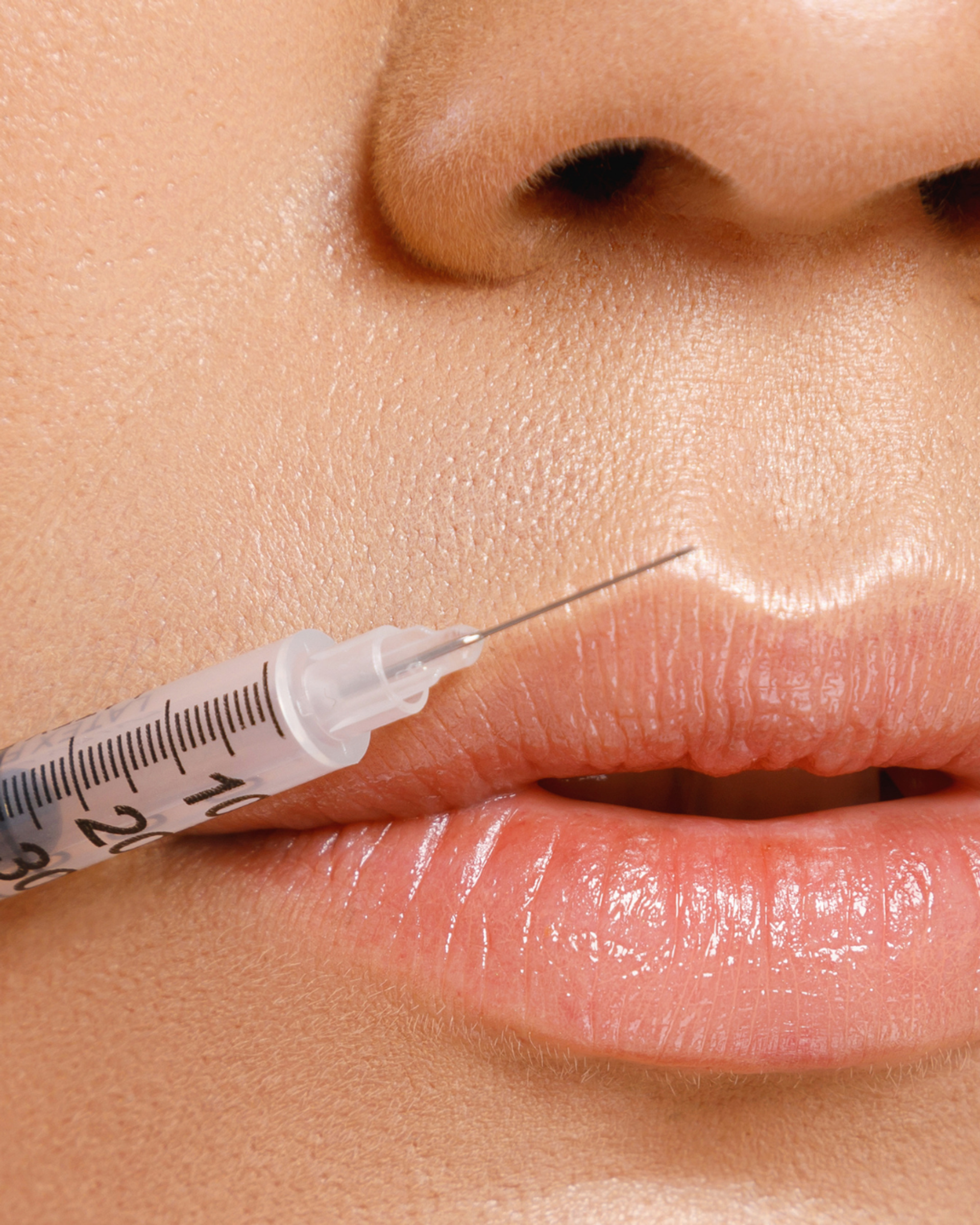 Lip Enhancement