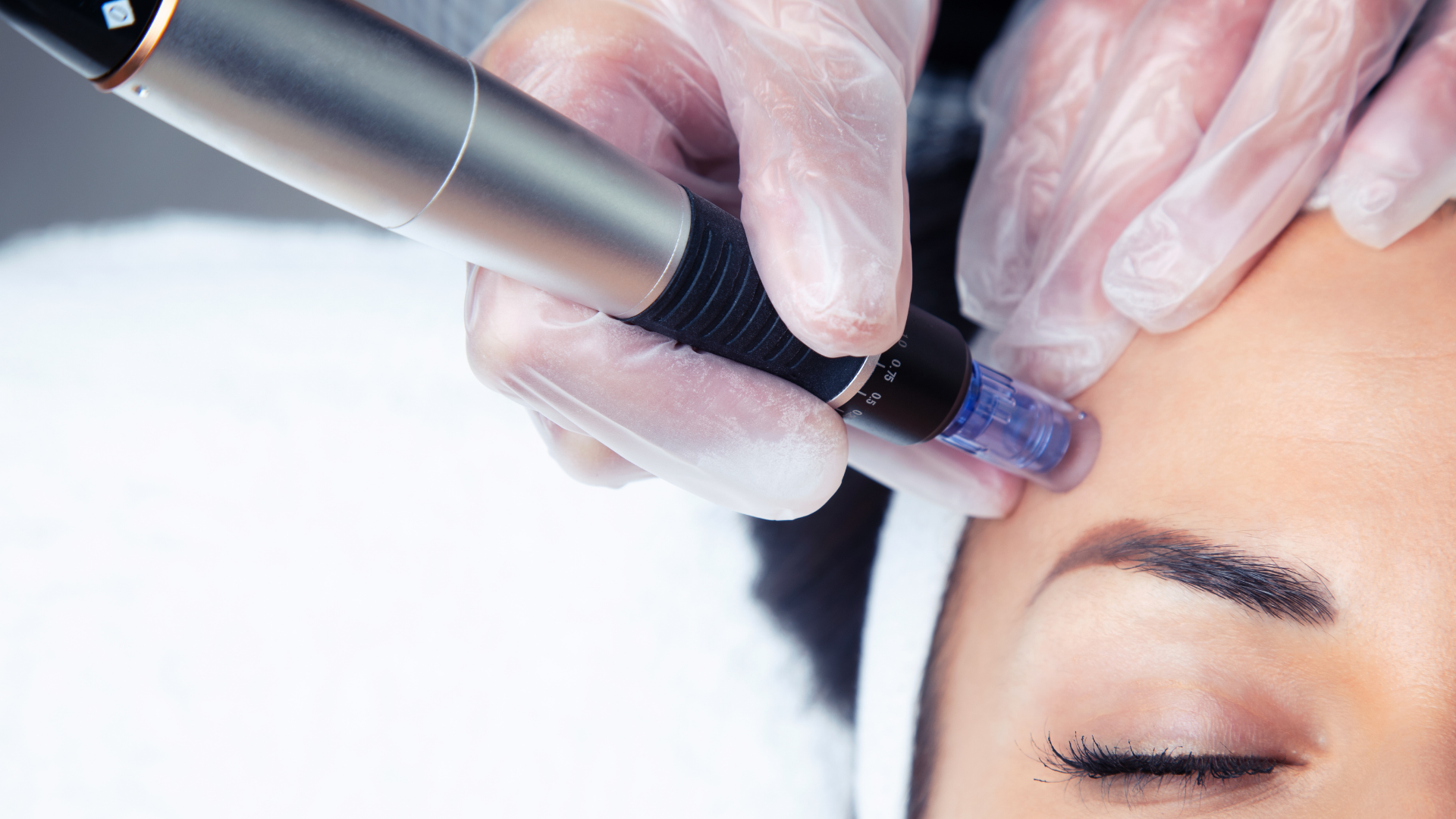 Microneedling (Dermapen)