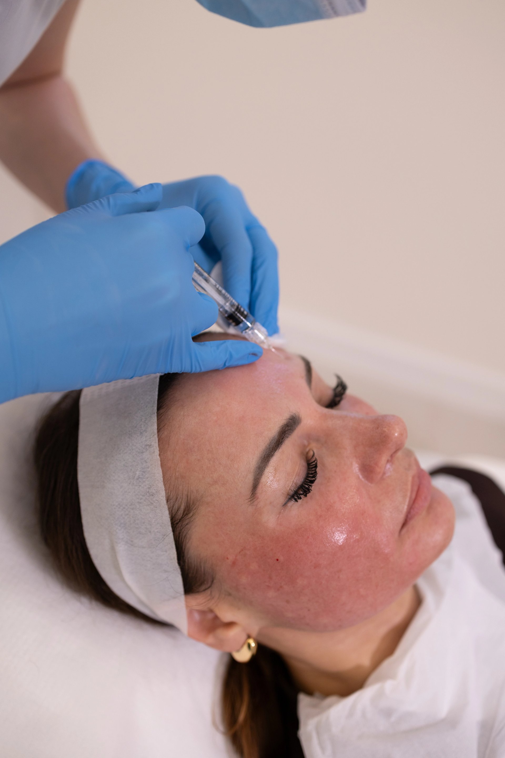 Mesotherapy aftercare