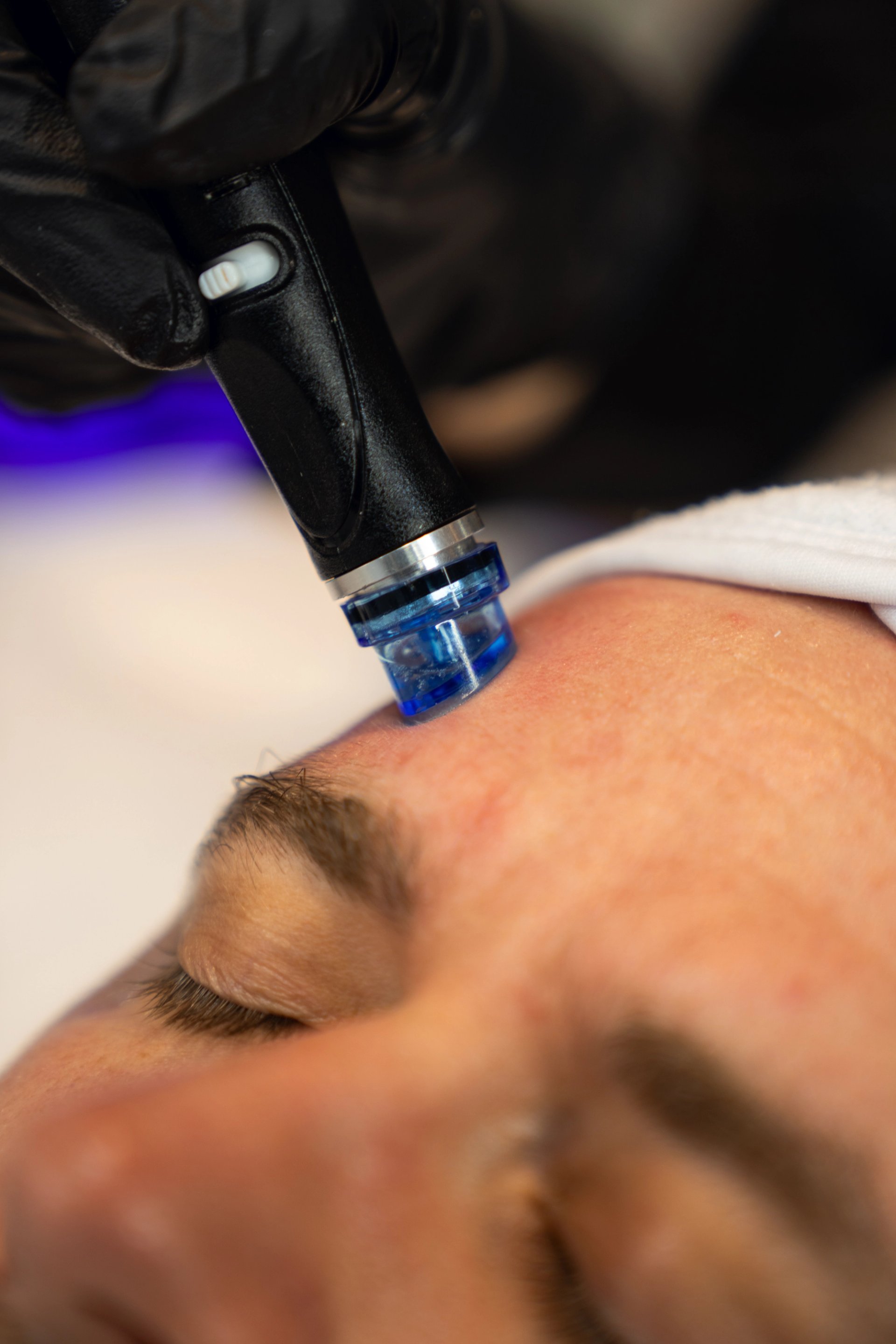 HydraFacial Elite