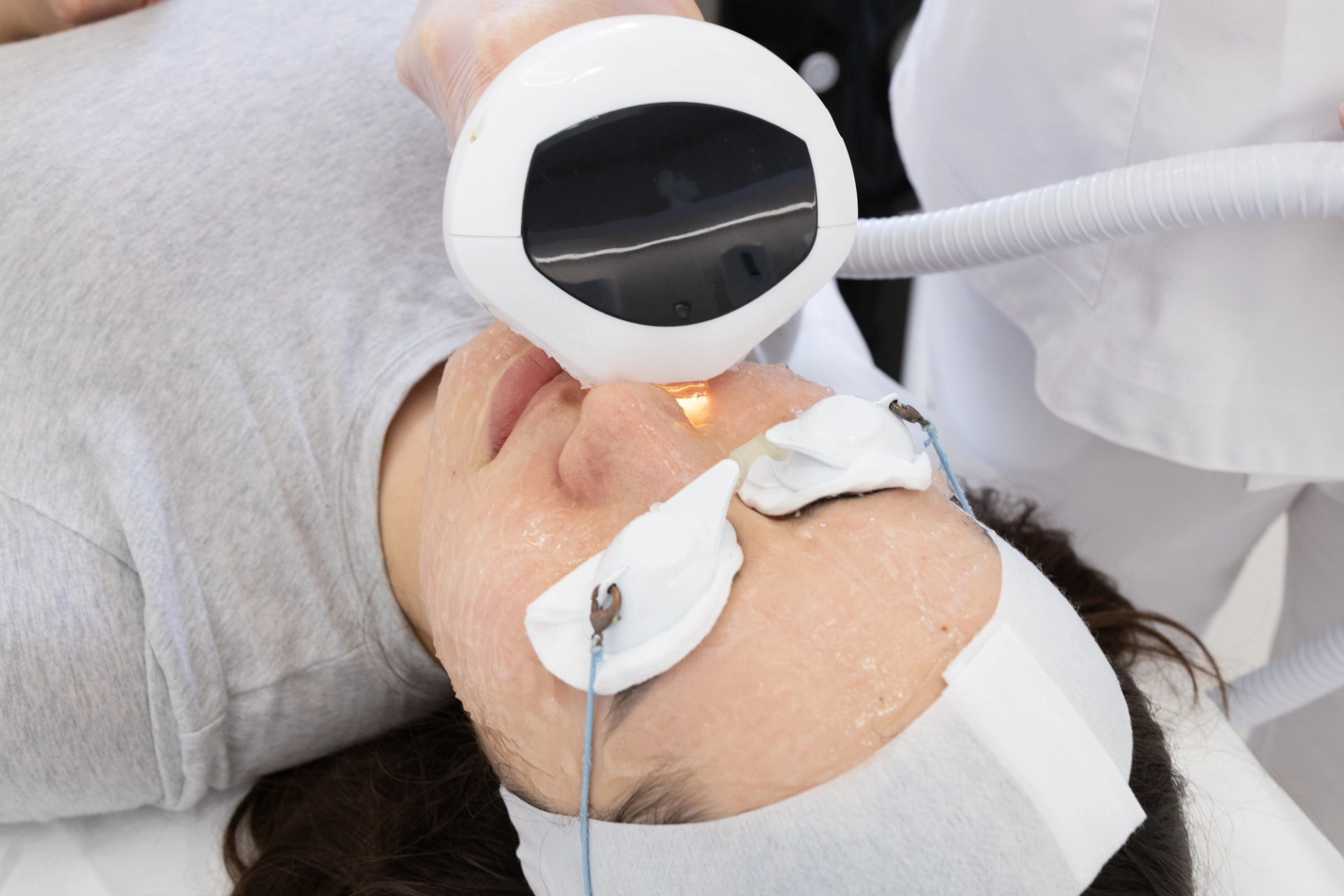 Acne Treatment Lumecca