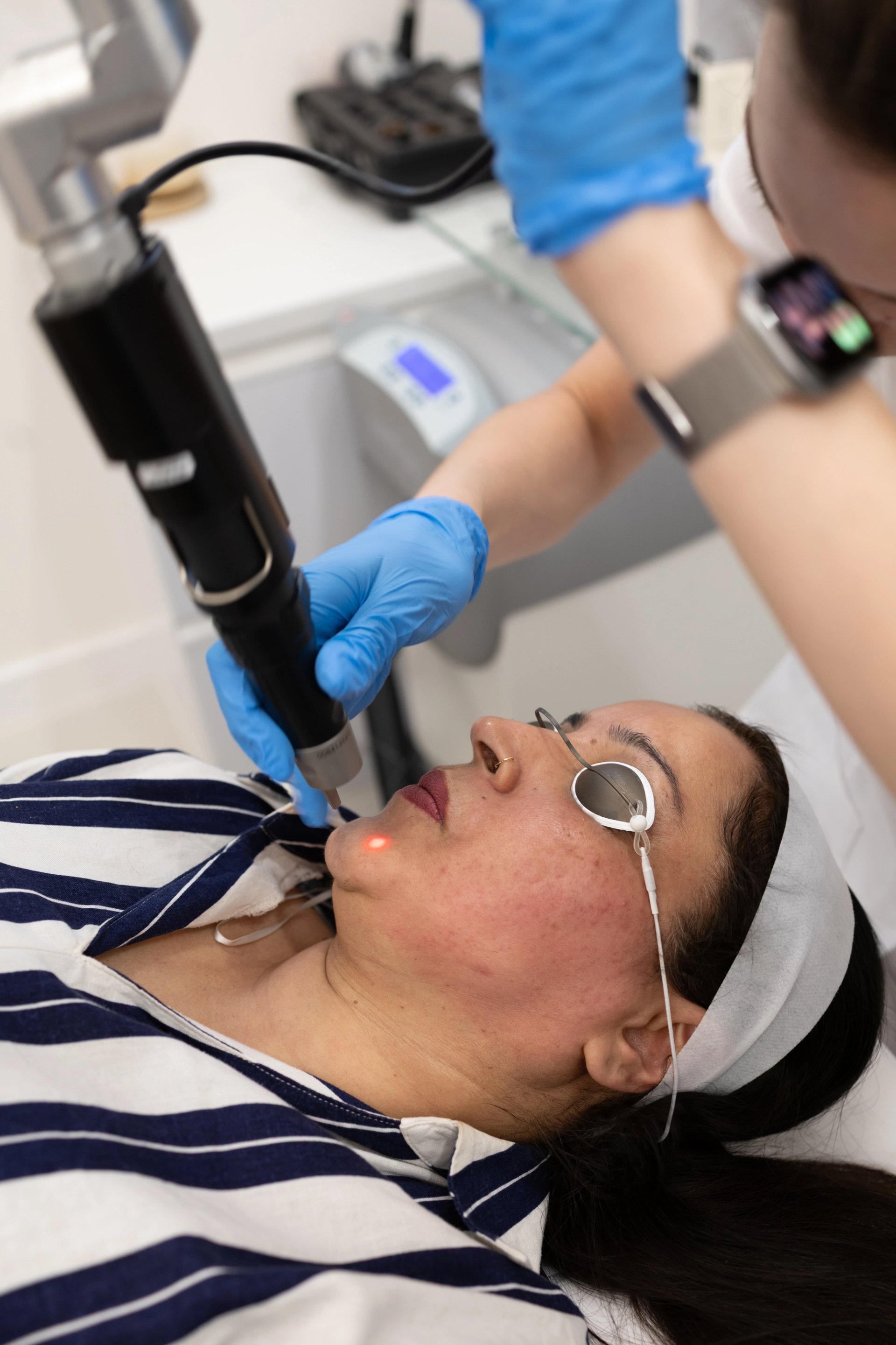 PicoSure Pro — Limited-Time Offer: course of 3 sessions just £1,100 (usually £1,650).