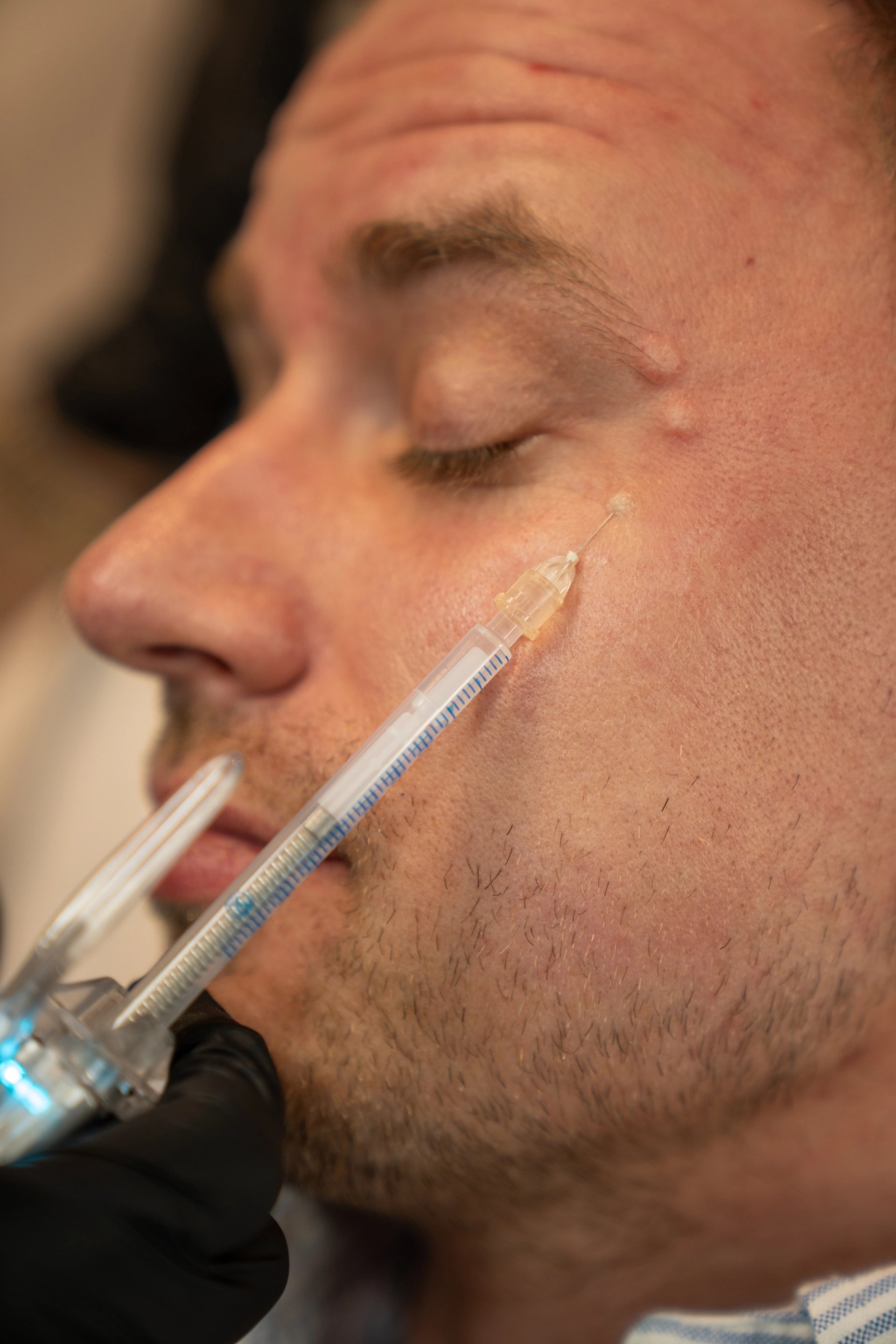 Anti-Wrinkle Injections aftercare