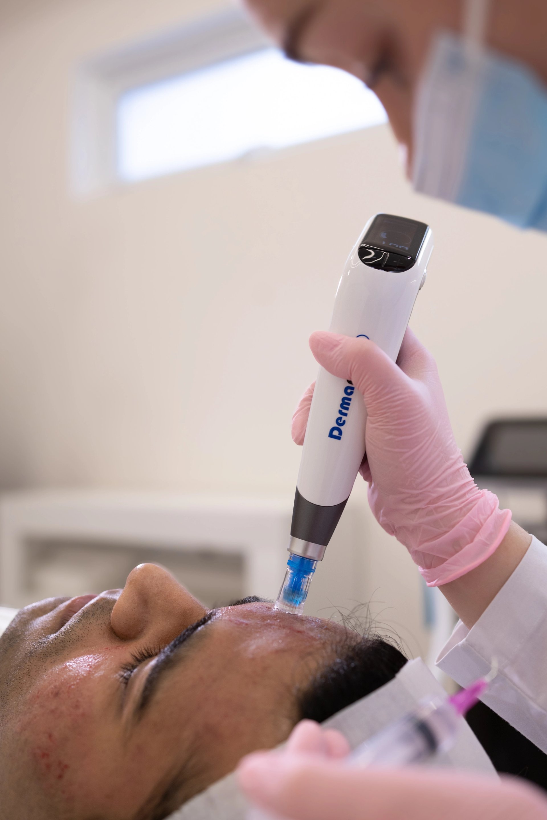 Dermapen + Exosomes: The Perfect Combination for Skin Regeneration and Renewal