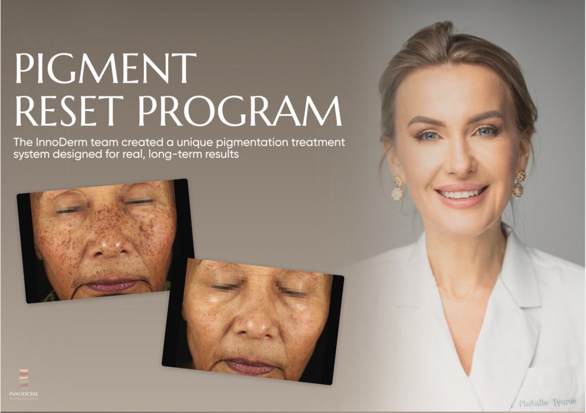 Pigment Reset Program