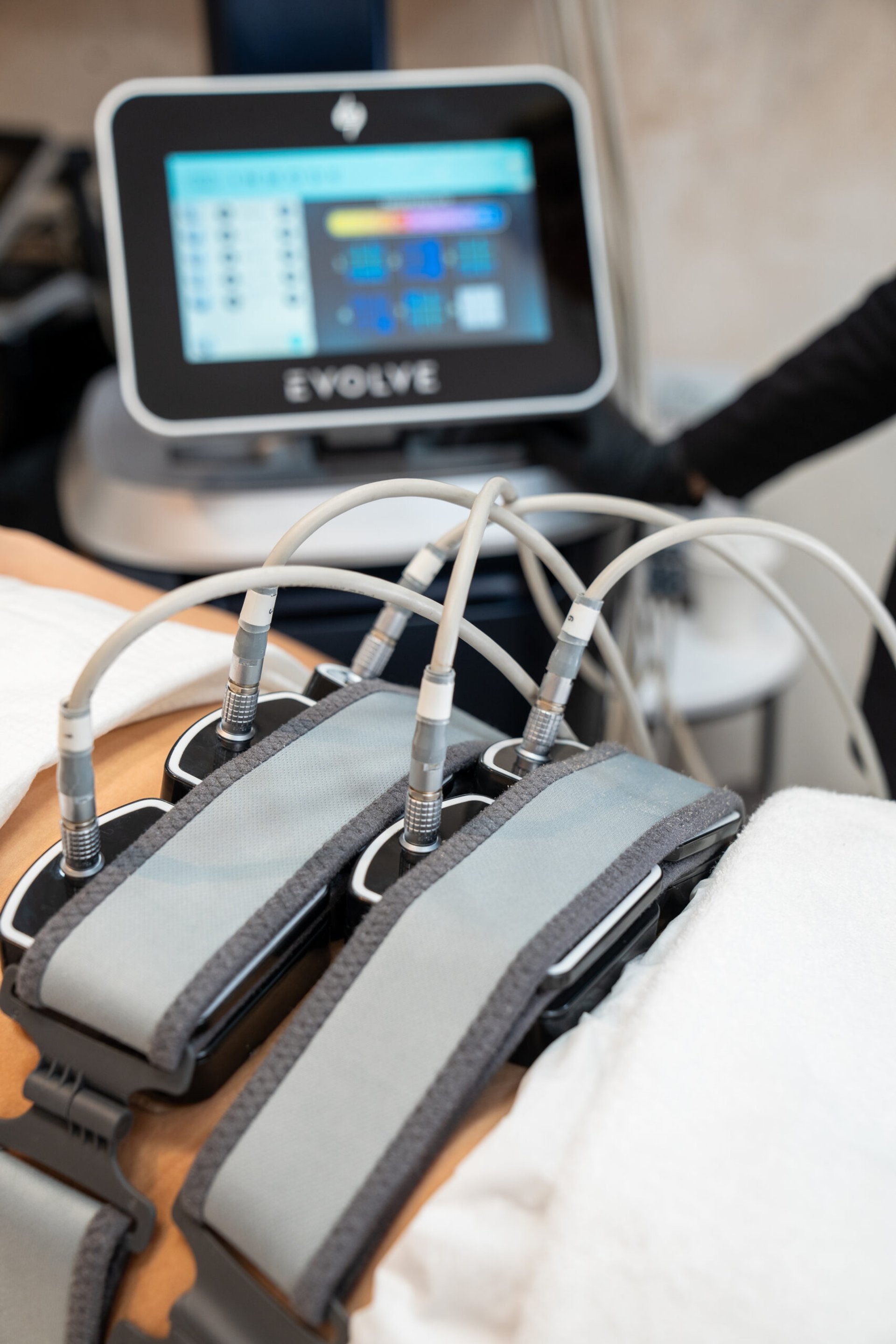 Preparing for Evolve X Body Contouring