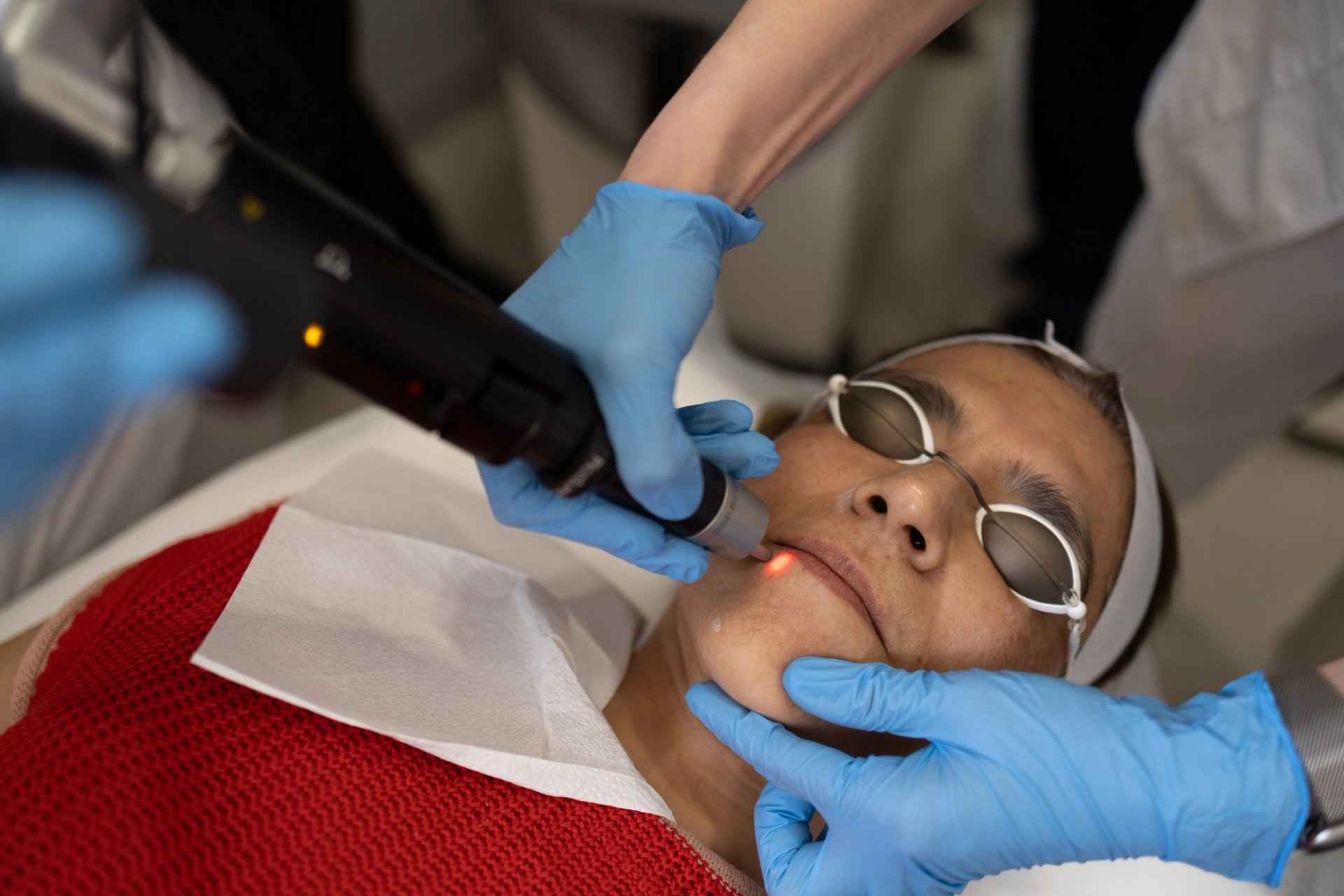 Best Melasma Treatment in London: PicoSure Pro at Innoderm Aesthetic Clinic